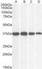 GAPDH antibody, 45-060, ProSci, Enzyme Linked Immunosorbent Assay image 