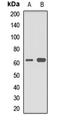 Excitatory amino acid transporter 4 antibody, LS-C668622, Lifespan Biosciences, Western Blot image 