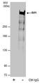 Replication Timing Regulatory Factor 1 antibody, PA5-78523, Invitrogen Antibodies, Immunoprecipitation image 