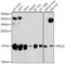 60S ribosomal protein L23 antibody, GTX64903, GeneTex, Western Blot image 