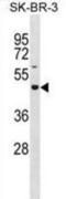 Glucoside Xylosyltransferase 2 antibody, abx031098, Abbexa, Western Blot image 