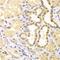 S100 Calcium Binding Protein A11 antibody, GTX33483, GeneTex, Immunohistochemistry paraffin image 