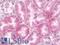 Gap Junction Protein Beta 1 antibody, LS-B12552, Lifespan Biosciences, Immunohistochemistry paraffin image 