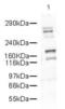 Dicer 1, Ribonuclease III antibody, PA5-19429, Invitrogen Antibodies, Western Blot image 