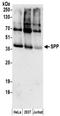 Minor histocompatibility antigen H13 antibody, NBP2-32276, Novus Biologicals, Western Blot image 