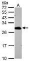 Aop2 antibody, PA5-30320, Invitrogen Antibodies, Western Blot image 