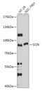 Adseverin antibody, 18-106, ProSci, Western Blot image 