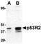 Ribonucleoside-diphosphate reductase subunit M2 B antibody, orb86743, Biorbyt, Western Blot image 