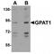 Glycerol-3-Phosphate Acyltransferase, Mitochondrial antibody, TA306579, Origene, Western Blot image 