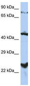 Magnesium Transporter MRS2 antibody, TA338429, Origene, Western Blot image 
