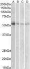 Synaptic vesicular amine transporter antibody, AP16297PU-N, Origene, Western Blot image 