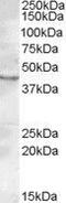 LAG1 longevity assurance homolog 3 antibody, GTX88586, GeneTex, Western Blot image 