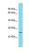 Myb/SANT DNA Binding Domain Containing 1 antibody, orb326907, Biorbyt, Western Blot image 