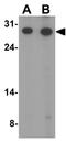 Aph-1 Homolog A, Gamma-Secretase Subunit antibody, GTX85061, GeneTex, Western Blot image 