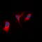 EPM2A Interacting Protein 1 antibody, orb78306, Biorbyt, Immunofluorescence image 