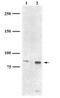 Fragile X mental retardation syndrome-related protein 2 antibody, GTX30602, GeneTex, Western Blot image 