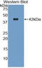 Natriuretic Peptide C antibody, LS-C293573, Lifespan Biosciences, Western Blot image 