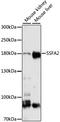 ITPR Interacting Domain Containing 2 antibody, A31926, Boster Biological Technology, Western Blot image 