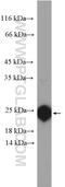 Retinol Binding Protein 4 antibody, 11774-1-AP, Proteintech Group, Western Blot image 