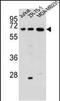 Zinc Finger And SCAN Domain Containing 2 antibody, PA5-48507, Invitrogen Antibodies, Western Blot image 