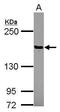 Protein Tyrosine Phosphatase Non-Receptor Type 14 antibody, PA5-31285, Invitrogen Antibodies, Western Blot image 