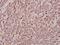 Rho Related BTB Domain Containing 2 antibody, A08572T85, Boster Biological Technology, Immunohistochemistry frozen image 