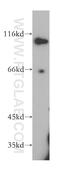 Sorting Nexin 25 antibody, 13294-1-AP, Proteintech Group, Western Blot image 