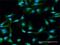 Syntaxin 11 antibody, H00008676-D01P, Novus Biologicals, Immunofluorescence image 