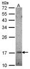 Ubiquitin-conjugating enzyme E2 B antibody, LS-C109312, Lifespan Biosciences, Western Blot image 