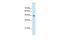 Eukaryotic Translation Elongation Factor 1 Gamma antibody, GTX46254, GeneTex, Western Blot image 