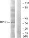 Progestin And AdipoQ Receptor Family Member 5 antibody, PA5-39626, Invitrogen Antibodies, Western Blot image 
