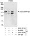 Sperm-associated antigen 5 antibody, A301-511A, Bethyl Labs, Immunoprecipitation image 