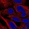 Coiled-Coil Domain Containing 130 antibody, PA5-63379, Invitrogen Antibodies, Immunofluorescence image 