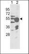 Cytochrome P450 Family 2 Subfamily R Member 1 antibody, PA5-15062, Invitrogen Antibodies, Western Blot image 