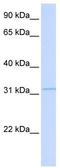 Retinol Dehydrogenase 12 antibody, TA338850, Origene, Western Blot image 