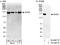 ATP-dependent RNA helicase A antibody, A300-854A, Bethyl Labs, Immunoprecipitation image 