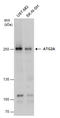 Autophagy Related 2A antibody, GTX131503, GeneTex, Western Blot image 