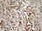 Mortality factor 4-like protein 1 antibody, M05547, Boster Biological Technology, Immunohistochemistry paraffin image 