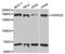 FA Complementation Group D2 antibody, orb48374, Biorbyt, Western Blot image 