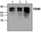 ANTXR Cell Adhesion Molecule 1 antibody, GTX59795, GeneTex, Western Blot image 