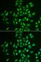 Beta-Secretase 1 antibody, orb373285, Biorbyt, Immunofluorescence image 