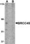 BRISC And BRCA1 A Complex Member 2 antibody, A32264, Boster Biological Technology, Western Blot image 