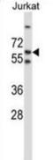 p56-LCK antibody, abx027836, Abbexa, Western Blot image 