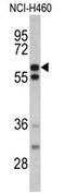 N-acetylglucosamine-6-sulfatase antibody, AP17435PU-N, Origene, Western Blot image 