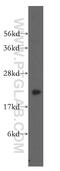 Dihydrofolate Reductase antibody, 15194-1-AP, Proteintech Group, Western Blot image 