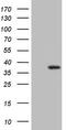 UTP11 Small Subunit Processome Component antibody, M12685, Boster Biological Technology, Western Blot image 