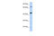 Elongation factor Tu, mitochondrial antibody, 27-185, ProSci, Enzyme Linked Immunosorbent Assay image 