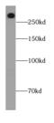 LDL Receptor Related Protein 2 antibody, FNab04847, FineTest, Western Blot image 