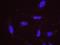 DNA Topoisomerase II Binding Protein 1 antibody, NB100-217, Novus Biologicals, Proximity Ligation Assay image 