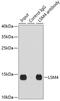 LSM4 Homolog, U6 Small Nuclear RNA And MRNA Degradation Associated antibody, GTX54350, GeneTex, Immunoprecipitation image 